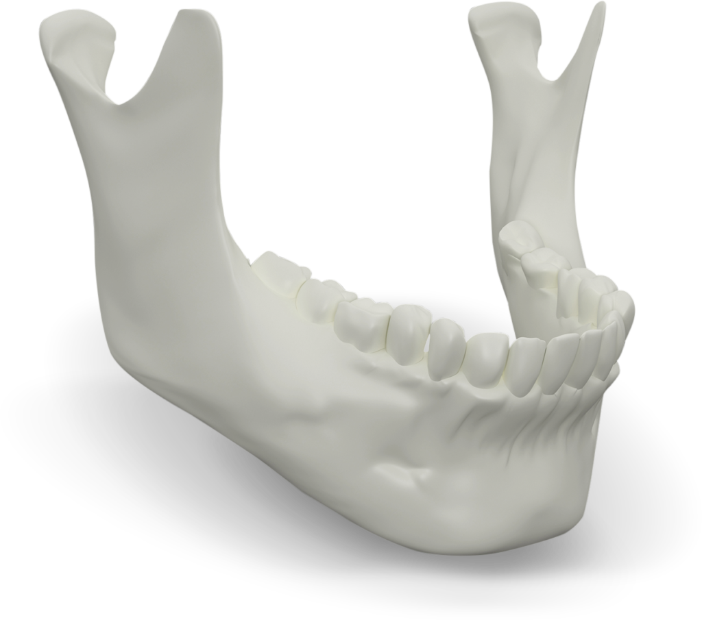 Jaw Bone Select Dental