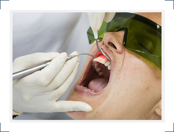 laser dentistry Select Dental
