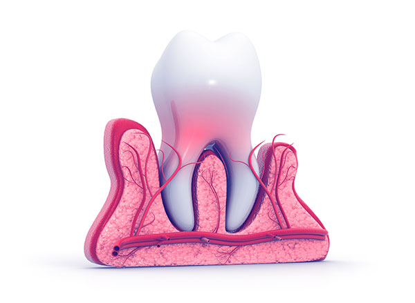 tooth pain Select Dental